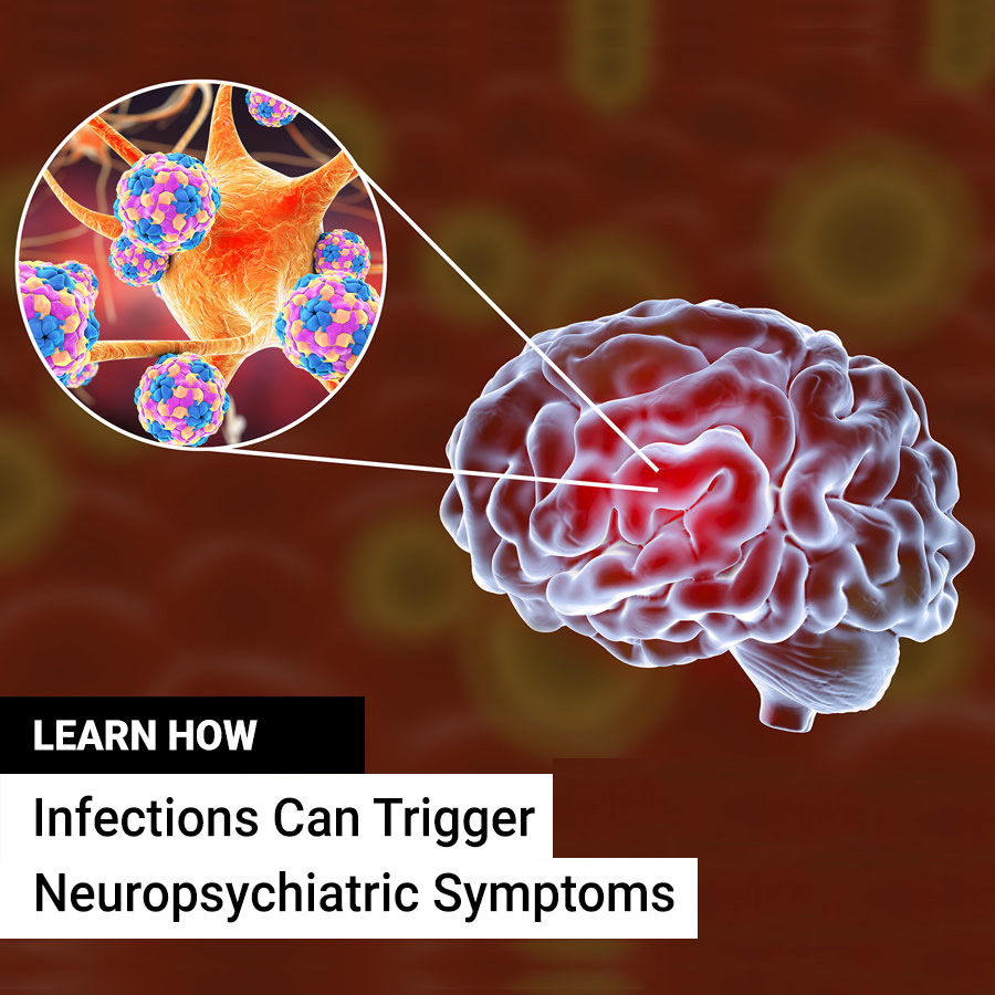 Learn How Infections Can Trigger Neuropsychiatric Symptoms