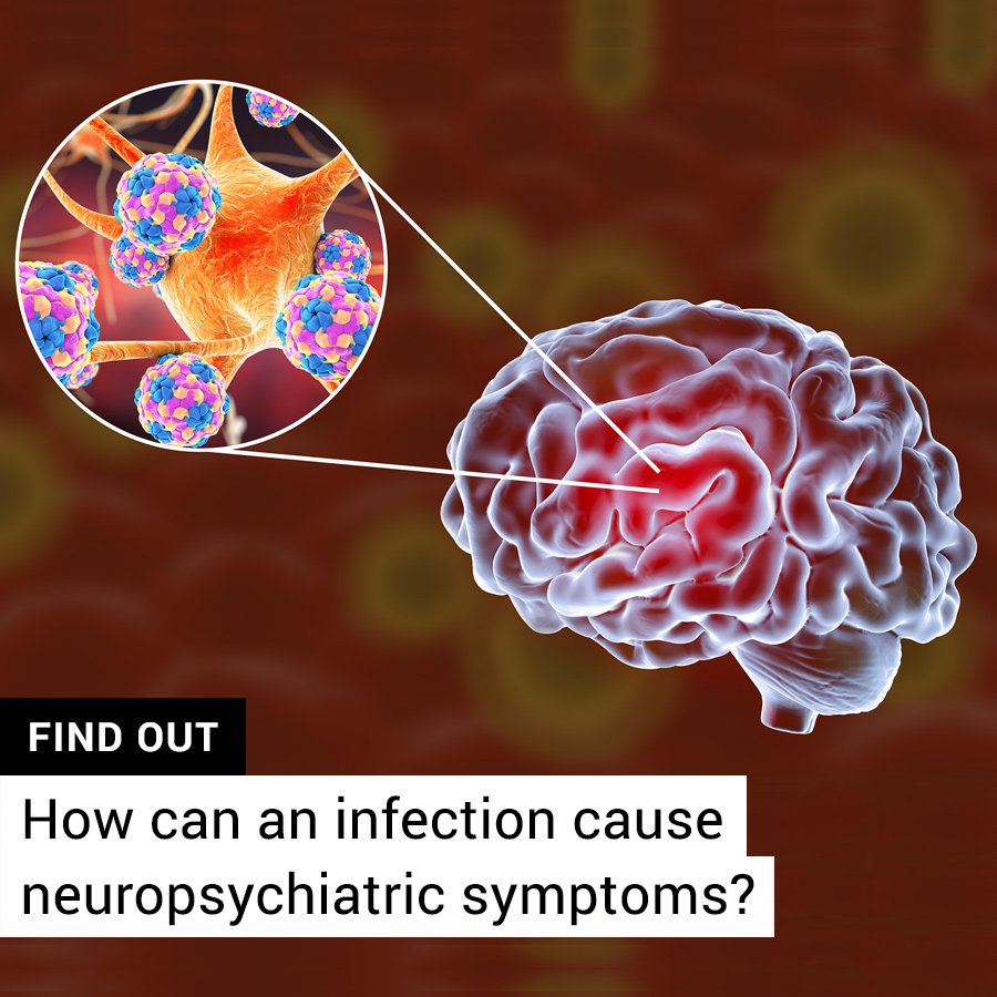 Can you develop neuropsychiatric symptoms from an infection?
