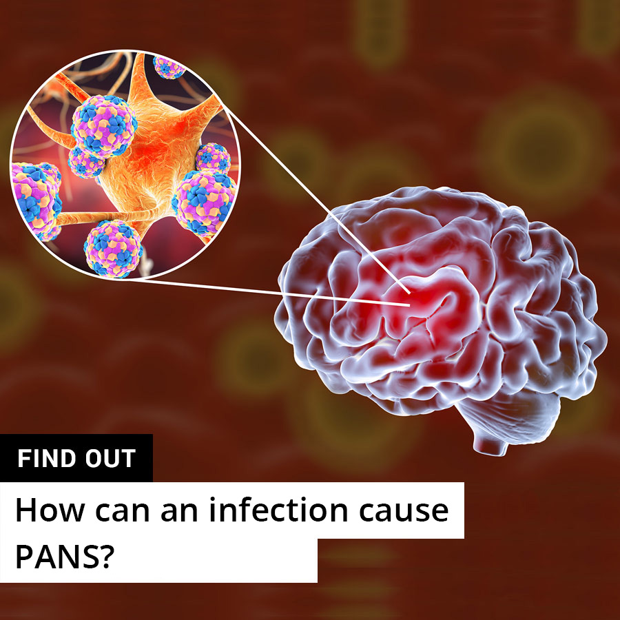 Can you develop PANDAS from an infection?